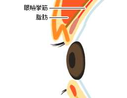 上瞼（うえまぶた）・目の上の切開法3