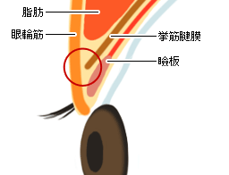 一重まぶたの断面図