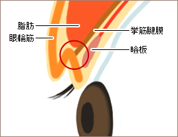 二重の幅を決めるためのシミュレーション6