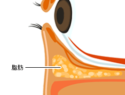 余分な脂肪を取り除きます