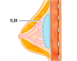 術後